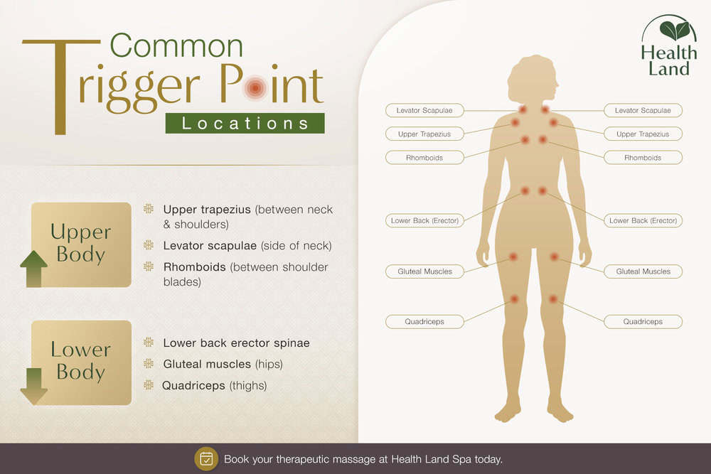 Common trigger point locations